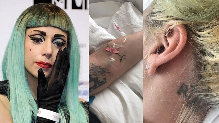 Lady Gaga decidió suspendió su gira por Brasil y mostró imágenes de su padecimiento