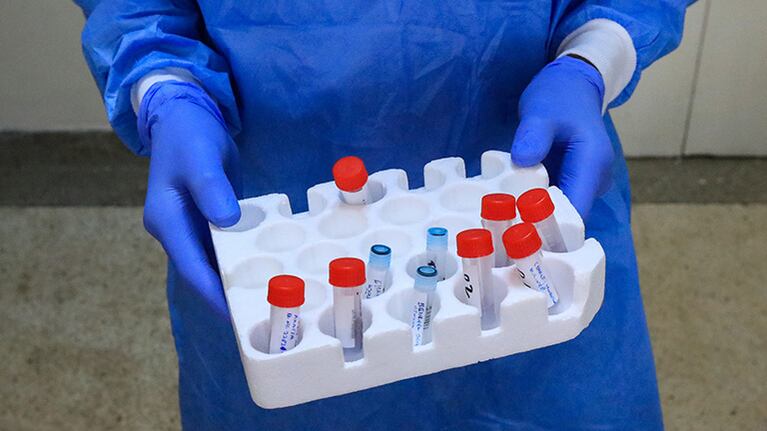 Las clínicas privadas de la Argentina podrán hacer el test de coronavirus