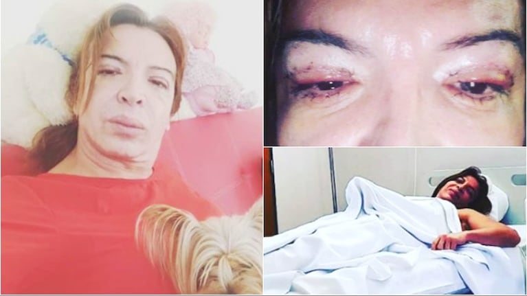 Las fotos de Lizy Tagliani tras su operación estética (Fotos: Instagram)