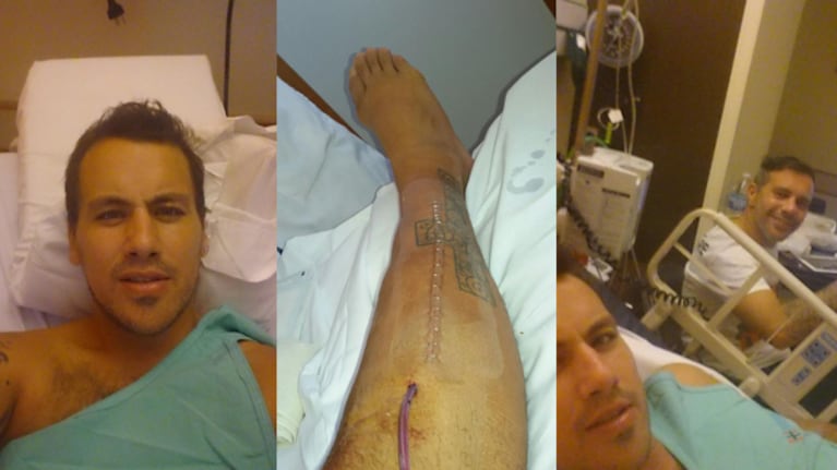 Las fotos tras la operación del Ogro Fabbiani. (Fuente: Twitter)