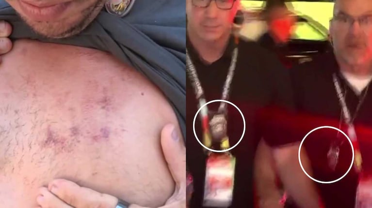 Las heridas de Martín Salwe en Kansas y las placas policiales de los agentes que lo agredieron (Fotos: capturas Infama)