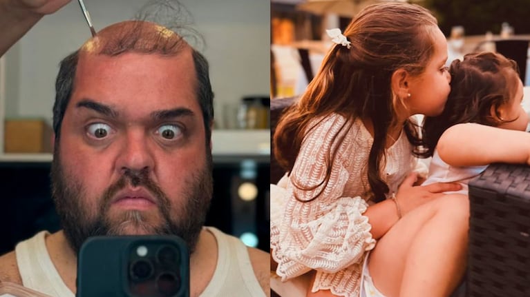 Las hijas de Darío Barassi revelaron su técnica para combatir la “pelada transitoria” de su papá.