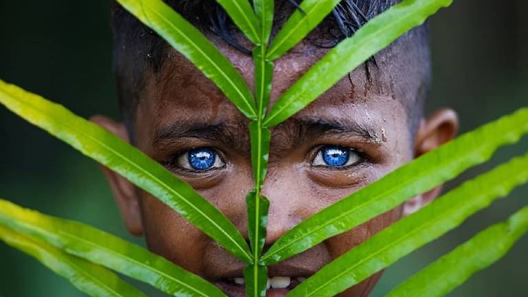 Las sorprendentes fotos de una tribu con una exótica mutación genética