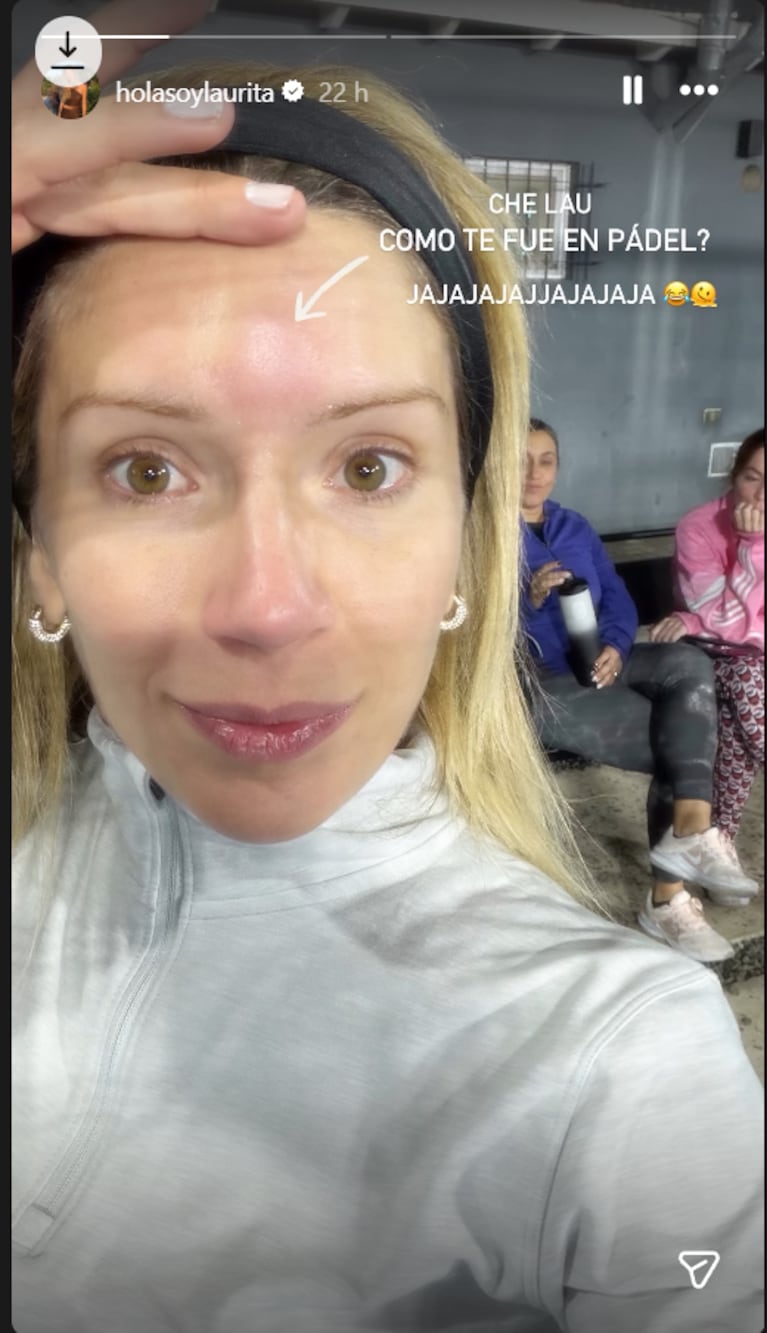 Laurita Fernández mostró el chichón que se hizo jugando al pádel: “Me la pegué bien”. Crédito: Instagram