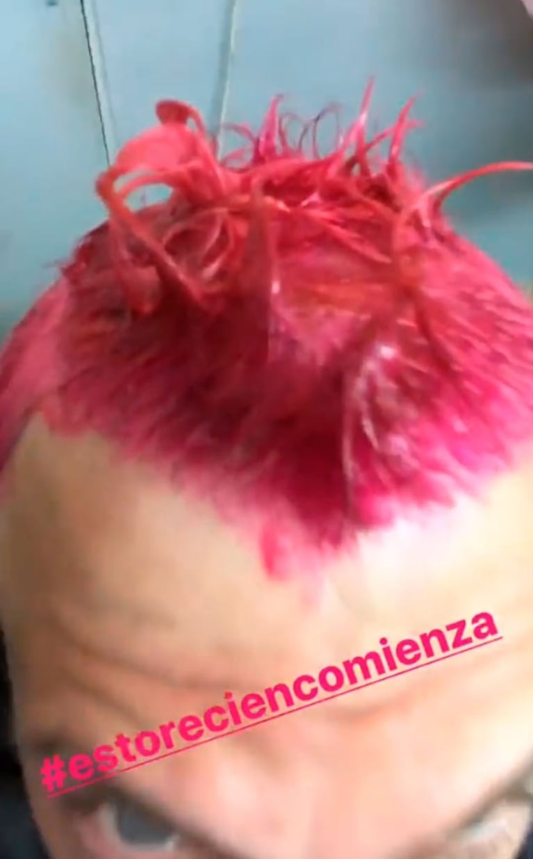 ¡Le puso color al verano! El cambio de look extremo del Polaco: cambió el platinado ¡por el fucsia! 