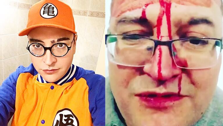 Leo García sufrió una brutal golpiza por parte de un grupo de homofóbicos.
