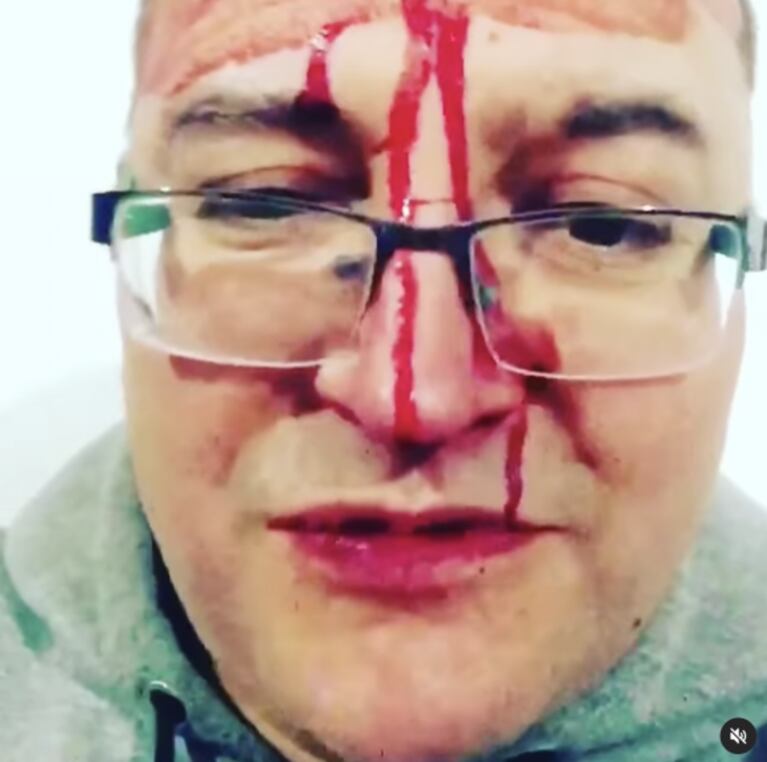 Leo García sufrió una brutal golpiza por parte de un grupo de homofóbicos: "Le tiré una onda gay y así respondieron"