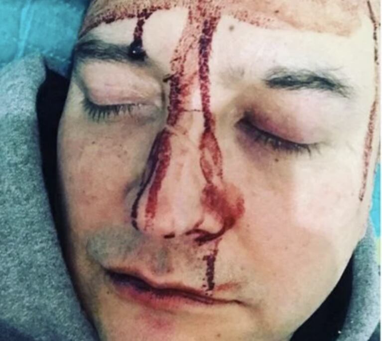 Leo García sufrió una brutal golpiza por parte de un grupo de homofóbicos: "Le tiré una onda gay y así respondieron"