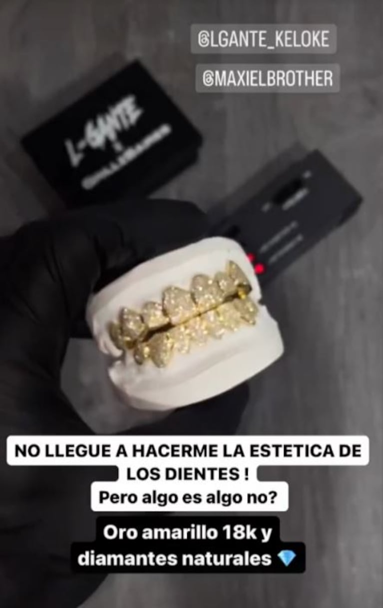 Los nuevos dientes de L-Gante (Foto: Instagram).