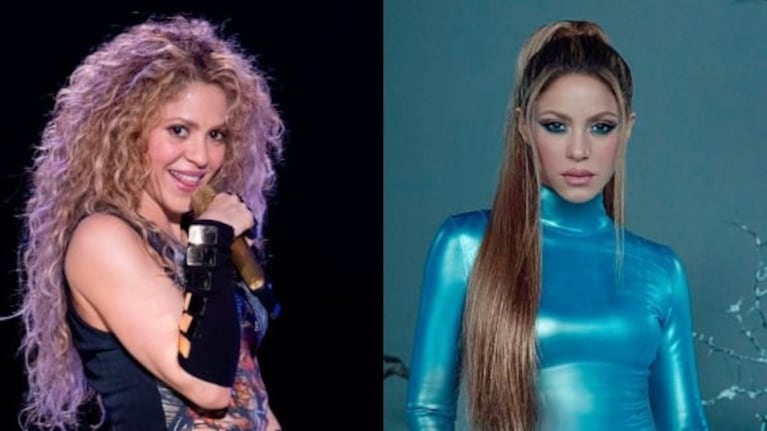 Los retoques estéticos que se habría hecho Shakira: de la mentoplastia a la bichotomia