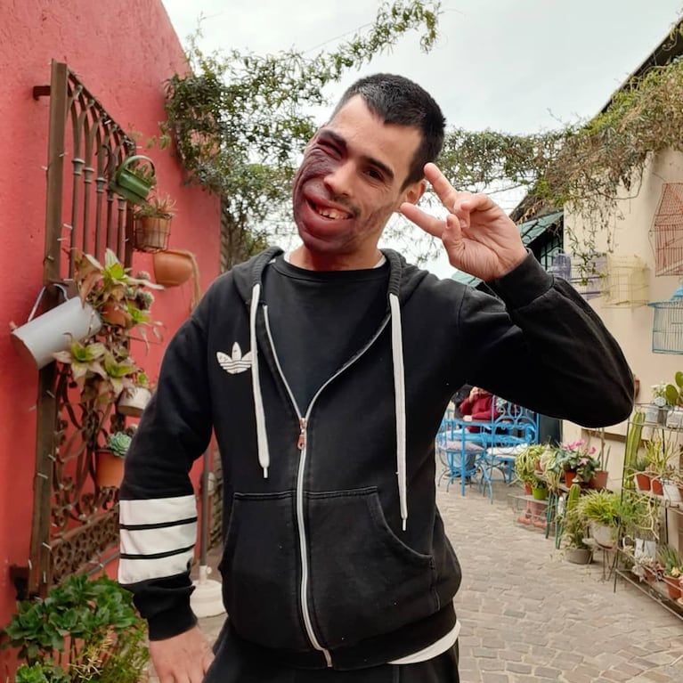 Lucas Benítez, el campeón de patín que fue agredido en el subte y reveló la discriminación que sufrió. Crédito: Instagram