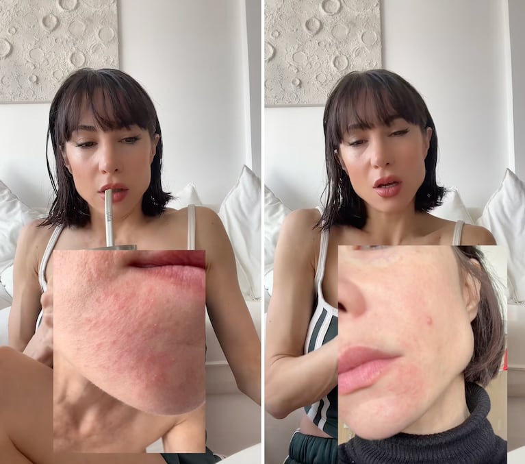 Magui Bravi mostró el brote que sufrió tras su separación  (Captura: TikTok @maguibravi)