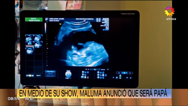 Maluma anunció en pleno show que va a ser papá: el emotivo momento