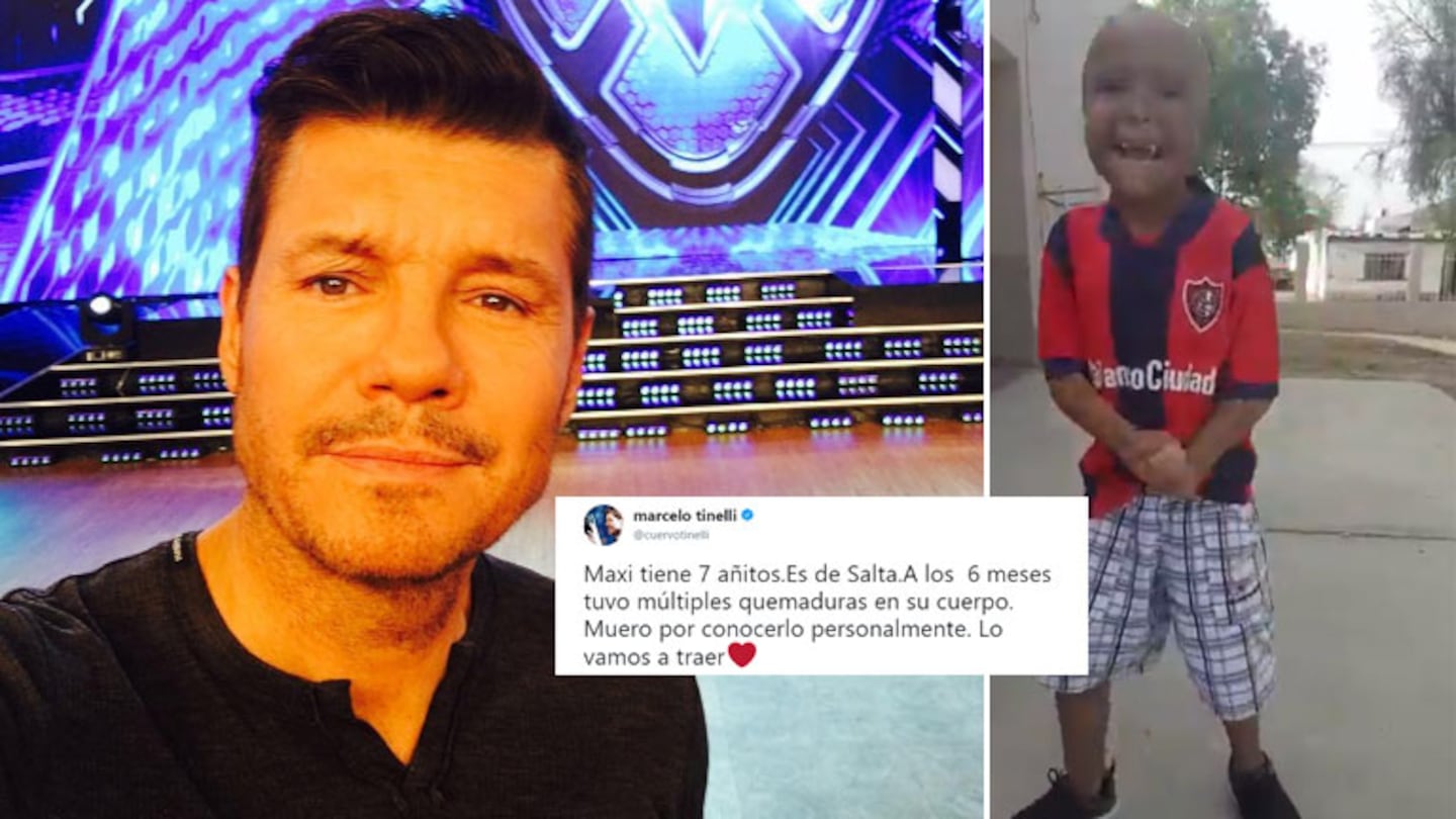 Marcelo Tinelli, conmovido con la dura historia de un niño de siete años: Maxi tuvo múltiples quemaduras; muero por...