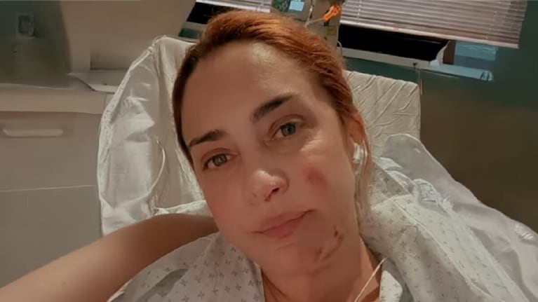 María Julia Oliván mostró las secuelas de su accidente. Crédito: Instagram/@majuliaolivan