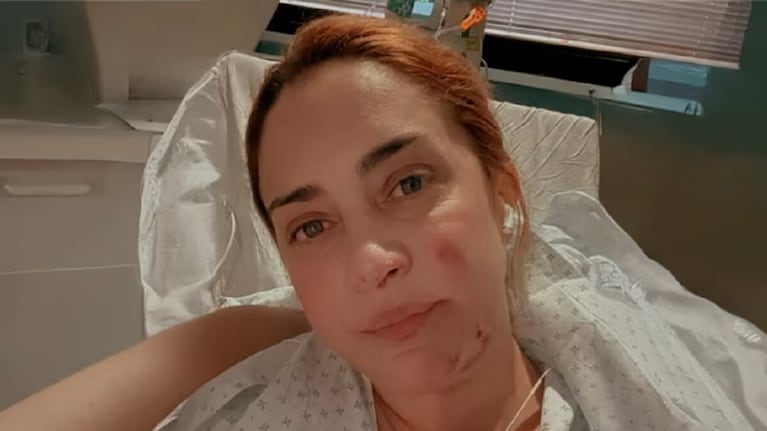 María Julia Oliván mostró las secuelas de su accidente. Crédito: Instagram/@majuliaolivan