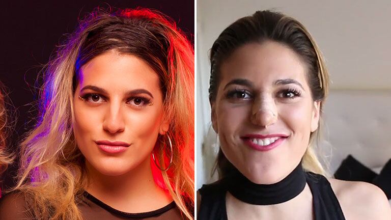 Marian Farjat, antes y después de su rinoplastía. Foto: Instagram.