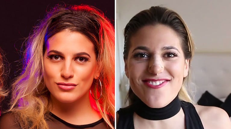 Marian Farjat, antes y después de su rinoplastía. Foto: Instagram.