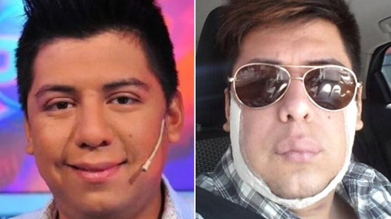 Mariano de la Canal, antes y después de su operación. (Fotos: @angeldebritoOK y Web)