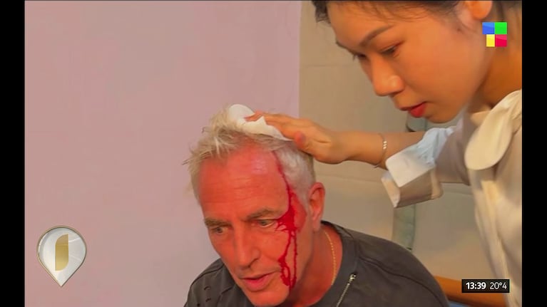 Marley se abrió la cabeza en Tailandia.