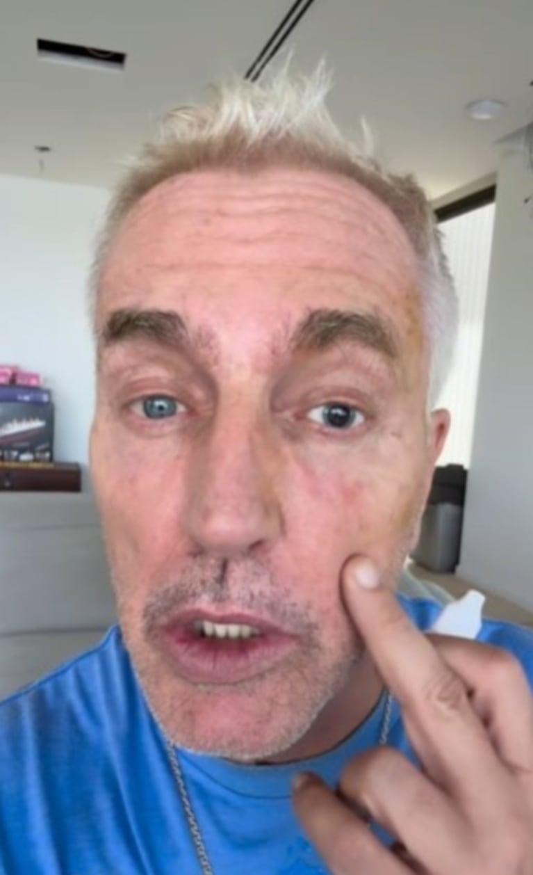 Marley se sometió a una cirugía que le cambió la vida: qué se hizo y cómo fue el proceso | Créditos: Instagram @marley_ok
