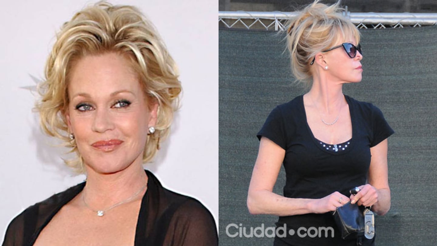 Melanie Griffith, el tremendo "antes y después" de la actriz. (Fotos: Grosby Group)