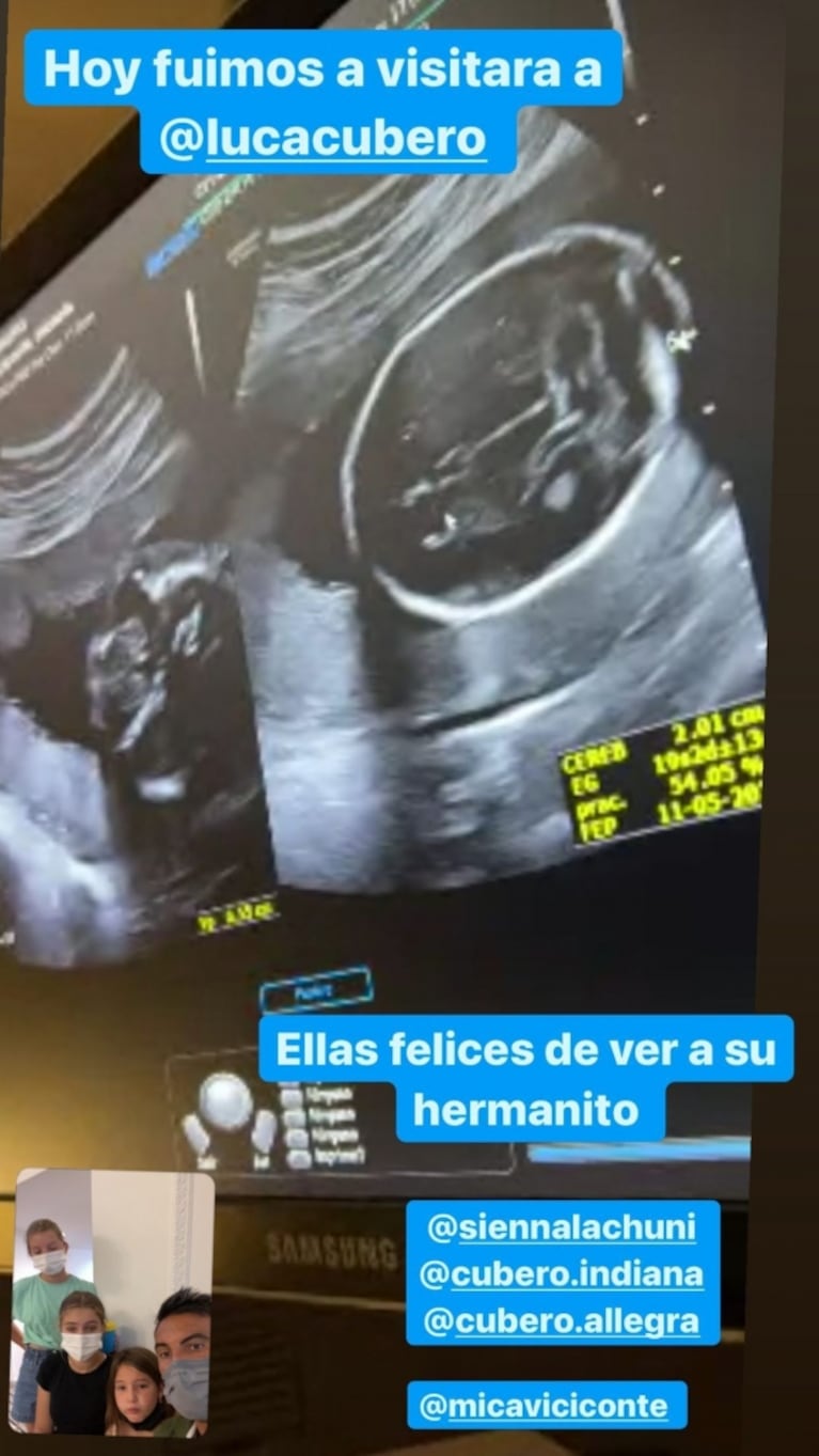 Mica Viciconte compartió una ecografía con la carita de su bebé y las hijas de Cubero la acompañaron por primera vez: "Te estamos esperando"