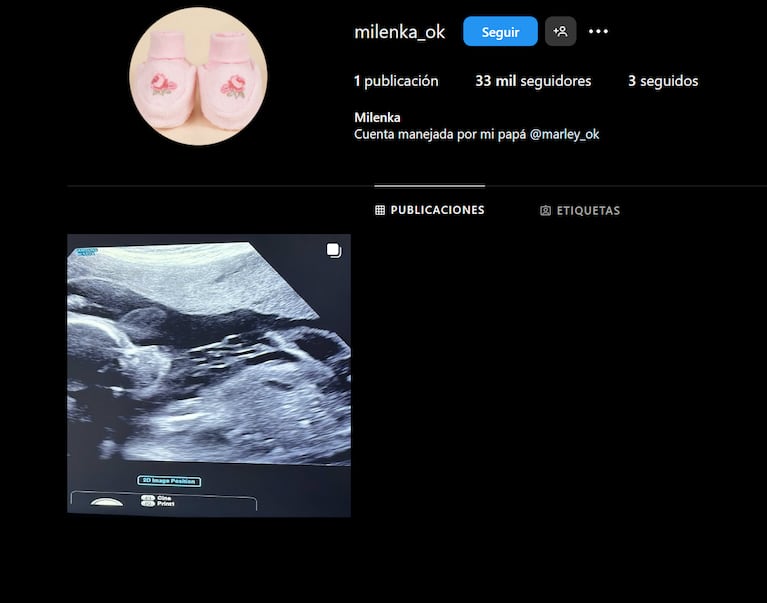 Milenka ya tiene cuenta de Instagram.