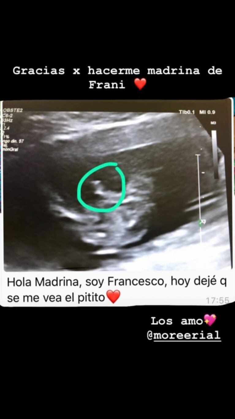 More Rial mostró una nueva ecografía de Francesco, su hijo en camino: "Hoy dejé que se me vea el pitito"