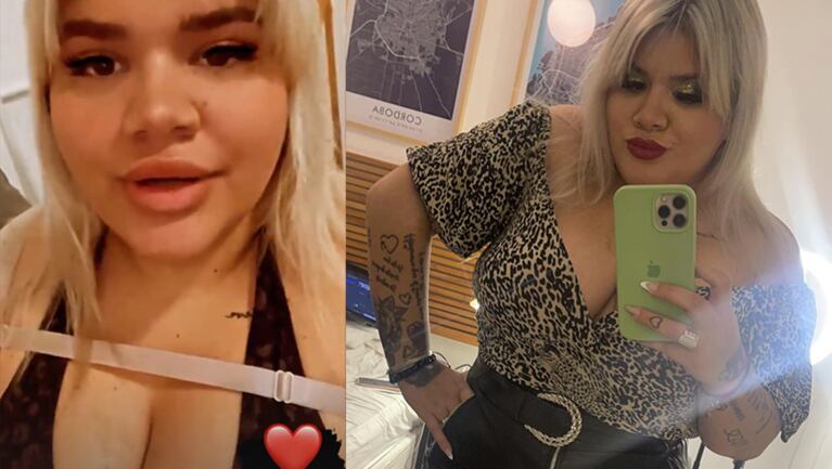 More Rial reveló para qué sirve la tira que usa alrededor de su busto tras sus cirugías estéticas.