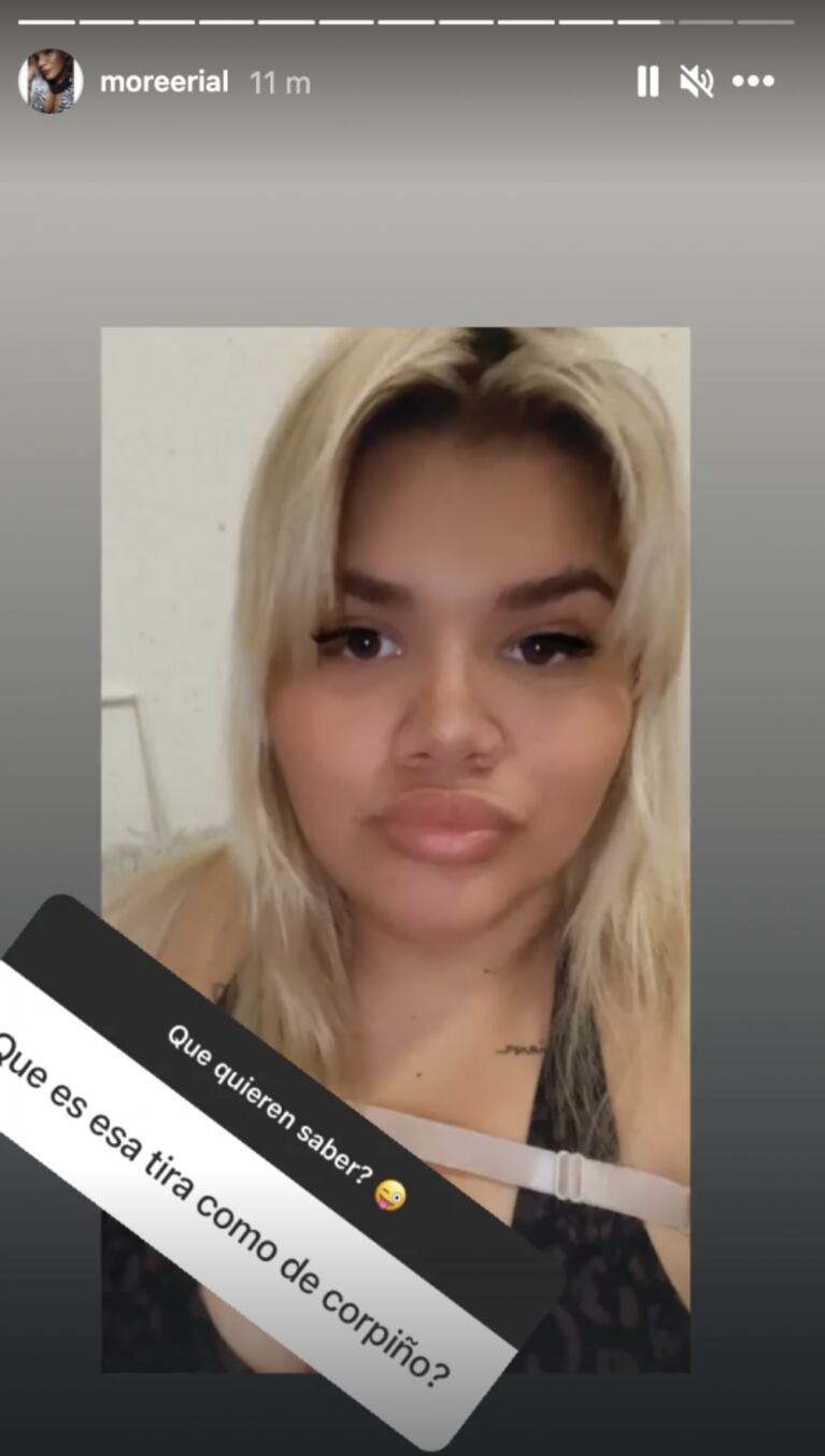 More Rial reveló para qué sirve la tira que usa alrededor de su busto tras sus cirugías estéticas: "Es parte de la faja"