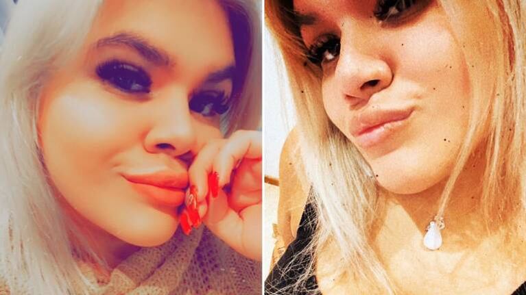 Morena Rial contó qué se hizo en los labios: “¡Sí, me inyecto ácido hialurónico!”