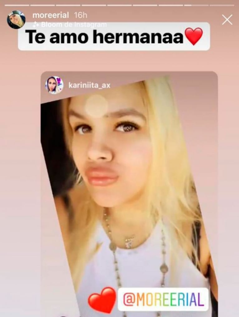 Morena Rial se puso colágeno en los labios: "¡Mirá esa boca, por Dios!"