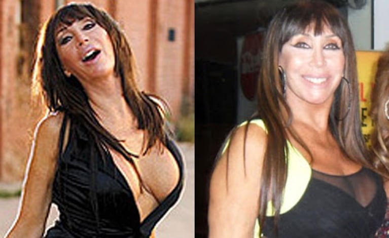 Moria Casán: el antes y el después de su operación de lolas (Foto: Web). 