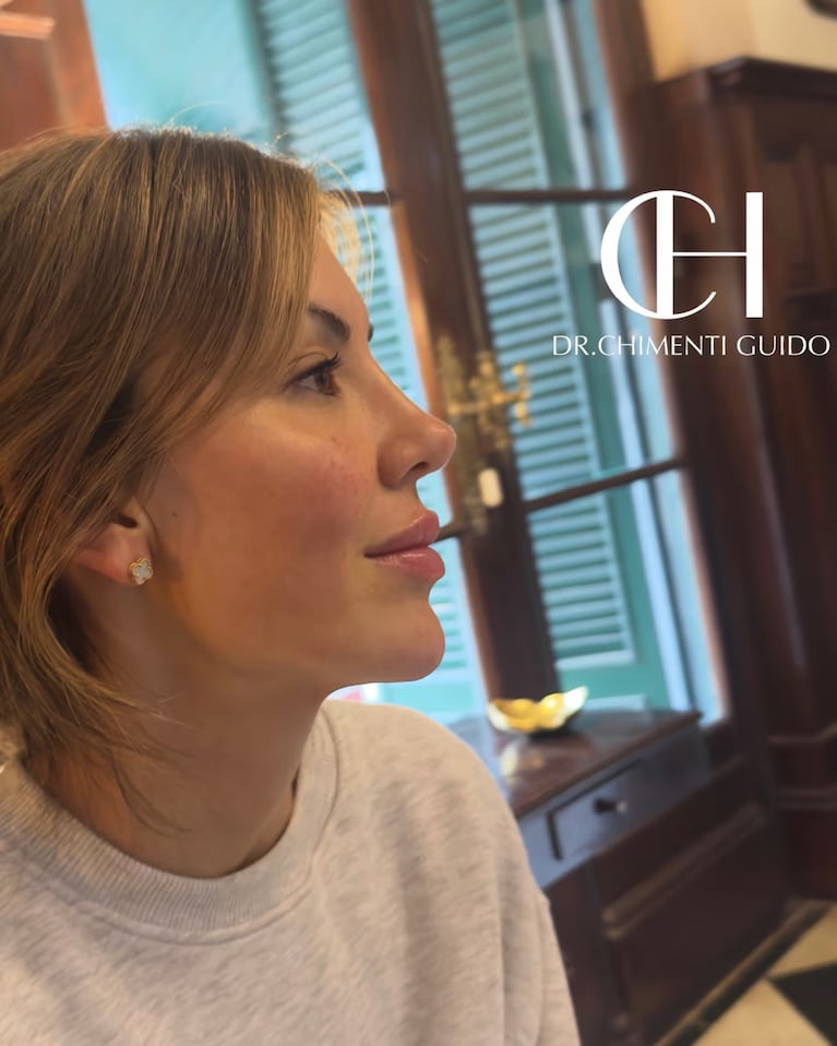 Muri López Benítez sorprendió a sus seguidores tras hacerse una intervención estética en medio de sus vacaciones en Argentina.