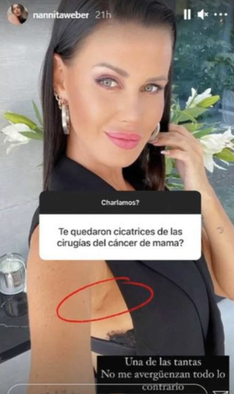 Natalie Weber mostró fotos de las cicatrices que le quedaron tras su mastectomía: "No me avergüenzan"