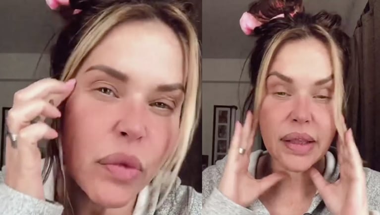 Nazarena admitió que se aplica botox.