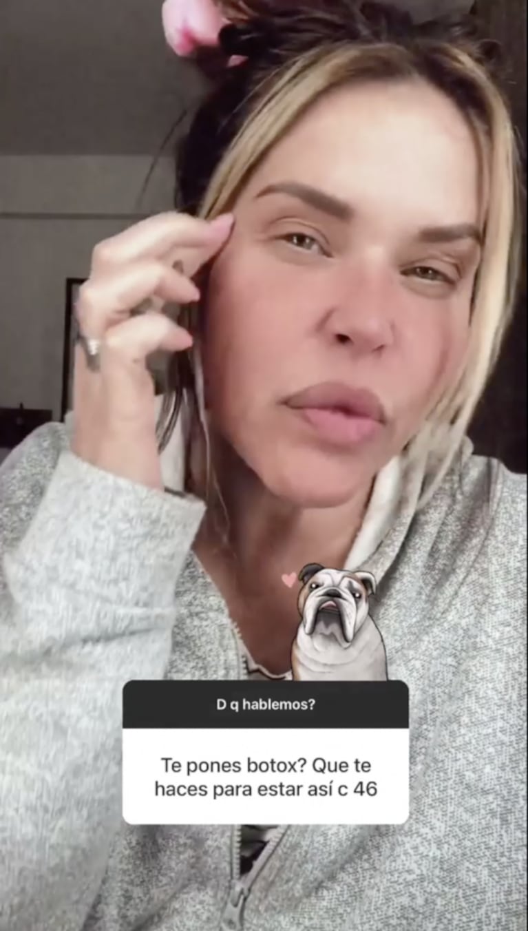 Nazarena Vélez reveló por qué se aplica botox en el rostro: "Algo tengo que hacer con esta cara de bulldog que se está cayendo"