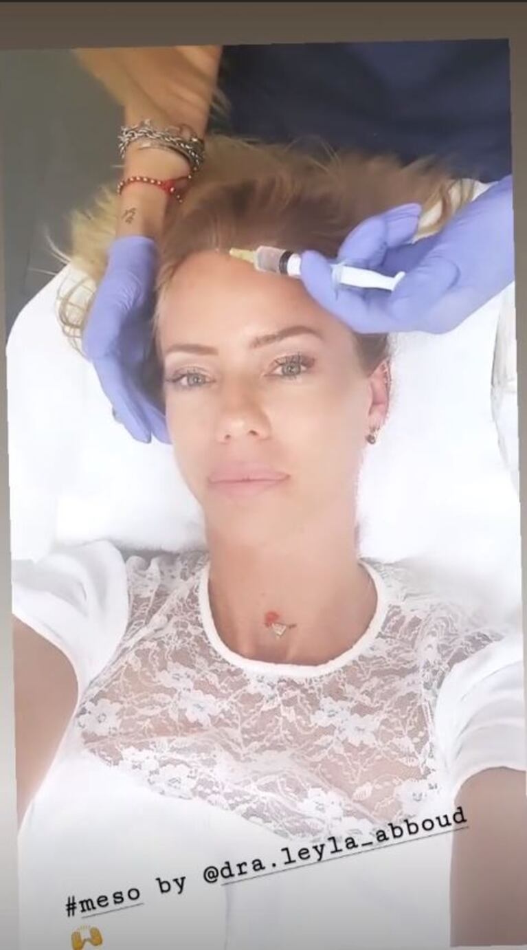 Nicole Neumann mostró cómo se aplica bótox en el rostro: ¿qué tratamiento se hace?