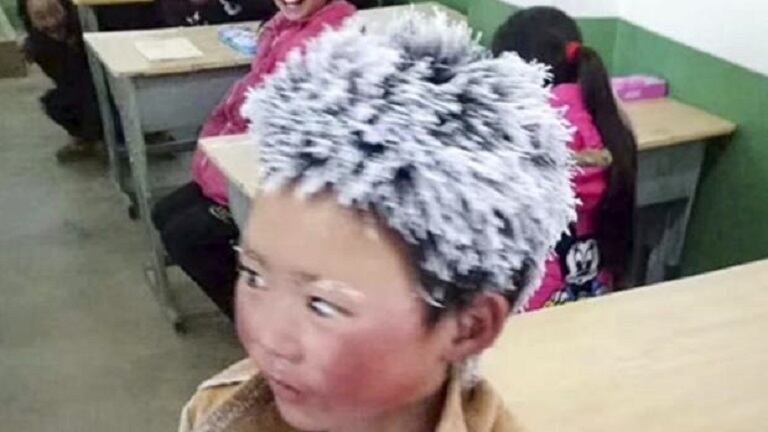 Niño con el pelo y las cejas congeladas causa conmoción en las redes