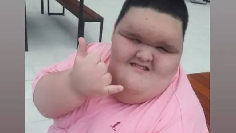Niño de 10 años pesa casi 200 kilos y necesita una operación urgente para no morir