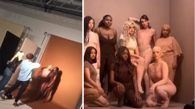 No hay barreras: joven con alopecia consigue trabajo como modelo
