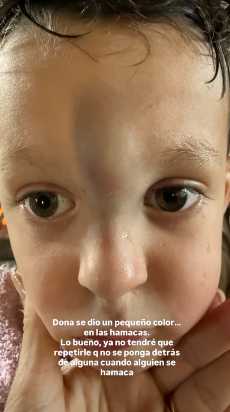 Noelia Marzol mostró el golpazo que se dio su hijo Donatello: “Va bajando, ponele” | Créditos: Instagram @noeliamarzolok