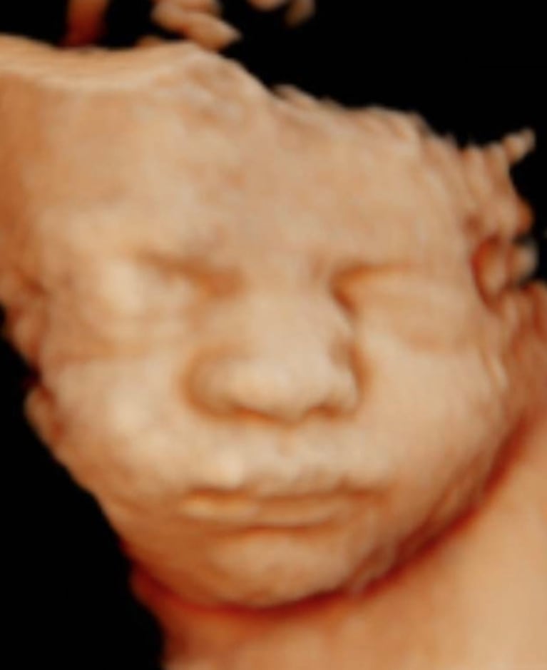 Noelia Marzol mostró el rostro de su beba en camino en una ecografía: "Mi trompuda"