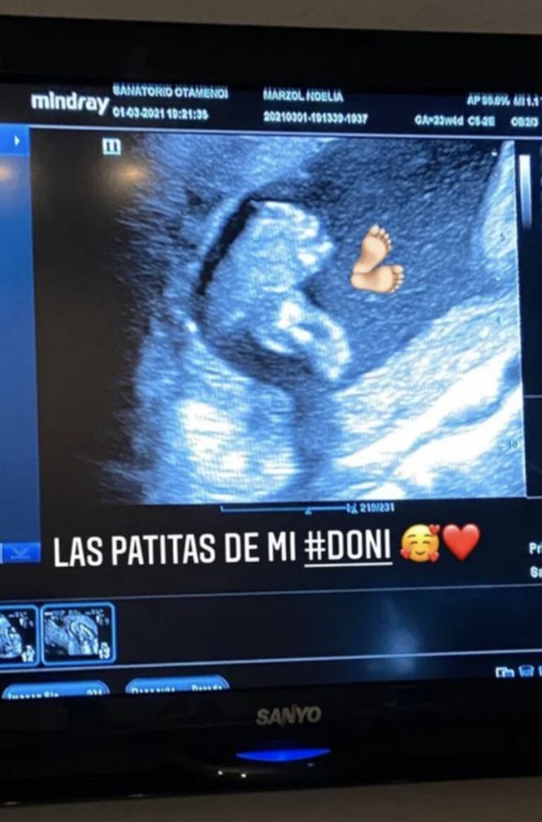 Noelia Marzol mostró la primera ecografía de su bebé: "¡Las patitas de mi Doni!"