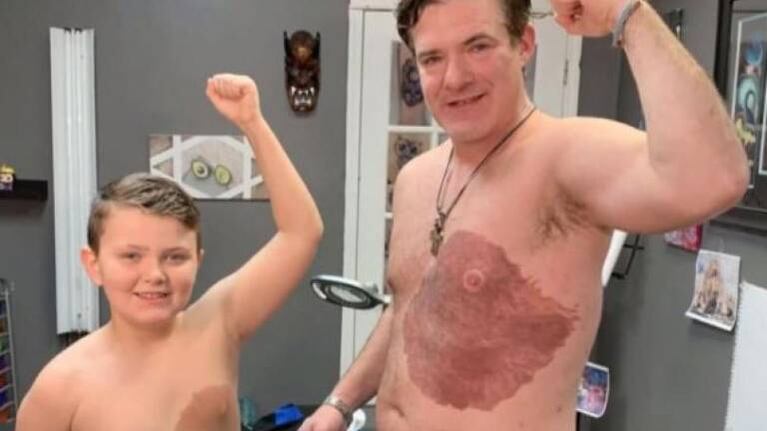 Padre decide tatuarse para copiar la mancha de nacimiento de su hijo