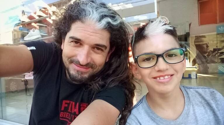 Padre e hijo comparten condición genética que lleva en su familia seis generaciones