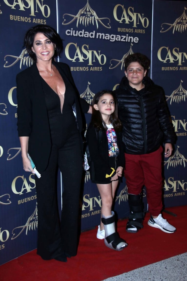 Pamela David contó cómo fue que sus dos hijos se lesionaron la pierna derecha ¡con un día de diferencia!