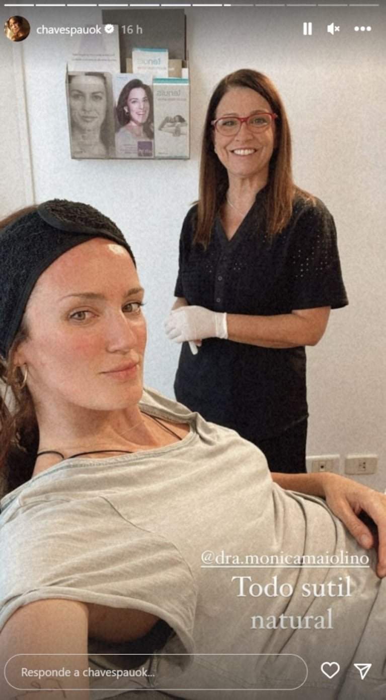 Paula Chaves mostró el paso a paso su tratamiento facial: "Vamos a inyectarle ácido hialurónico"