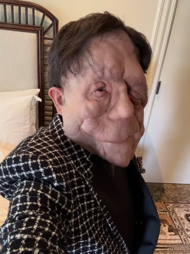 Premios Oscars 2026: quién es Adam Pearson, el actor con neurofibromatosis que genera conciencia sobre su enfermedad | Créditos: Instagram @adampearson